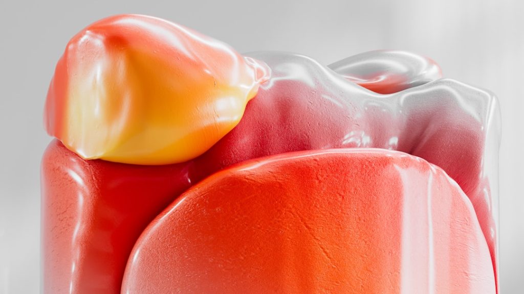 Photo Blood-Sugar-Friendly Meal Swaps